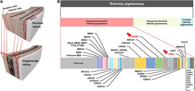 Electrically-evoked responses for retinal prostheses are differentially altered depending on ganglion cell types in outer retinal neurodegeneration caused by Crb1 gene mutation